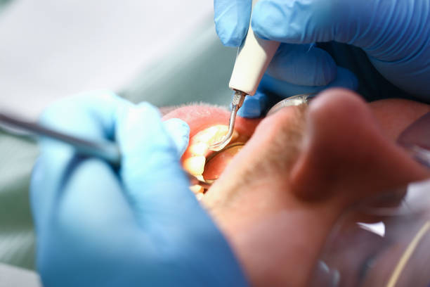 Best After-Hours Dental Trauma Care in Cridersville, OH