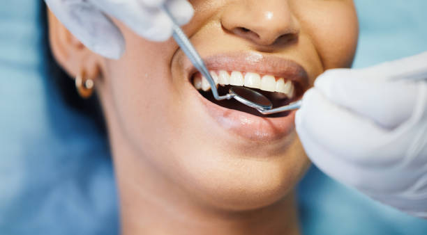 Best Same-Day Emergency Dental Services in Cridersville, OH