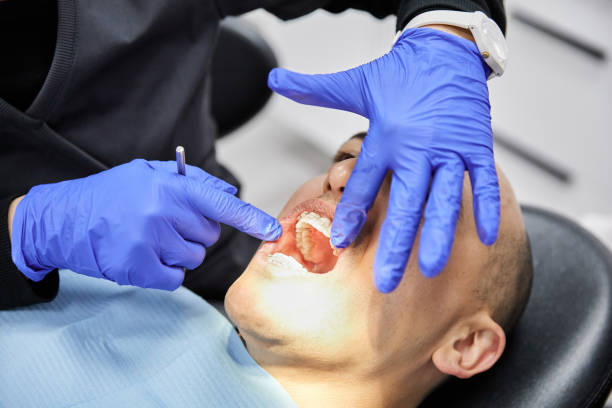 Best Emergency Treatment for Dental Infections or Abscesses in Cridersville, OH
