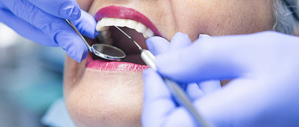 Best Urgent Care for Lost Fillings or Crowns in Cridersville, OH